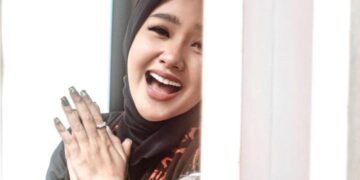 Terkena Penyakit Autoimun, Cita Citata Akui Kesalahan Pribadi